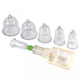 Rimba 6 Piece Cupping Set Pump System Skin Suction Vacuum Circulation Fetish BDSM